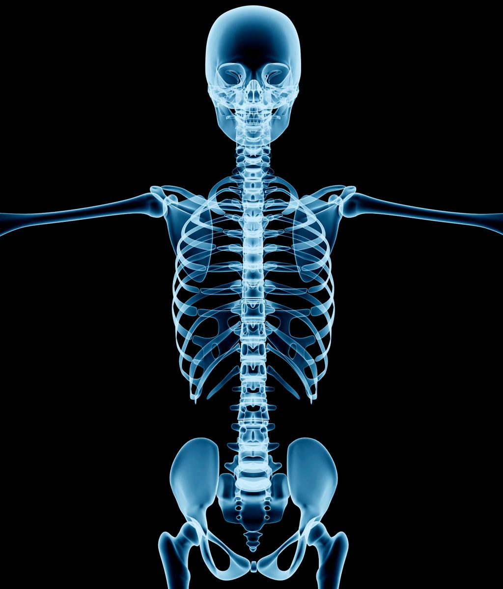 Digital X-Ray