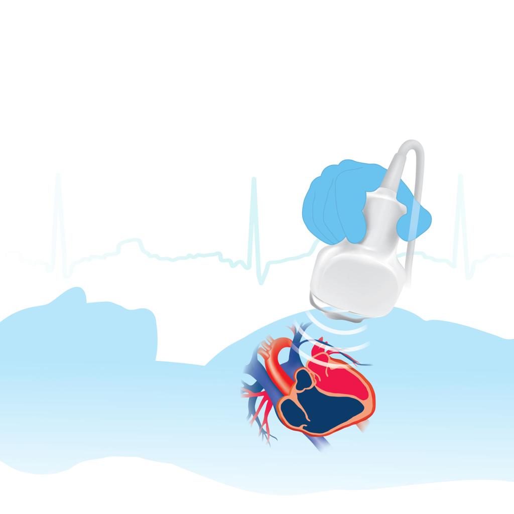 Echocardiography Services